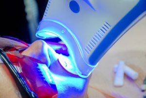 led light teeth whitening
