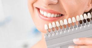 porcelain veneers for crooked teeth