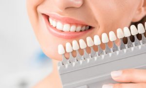 factors how to whiten teeth overnight