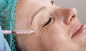 using injection to remove eyw wrinkles
