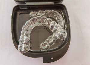 invisalign teeth attachments clear trays