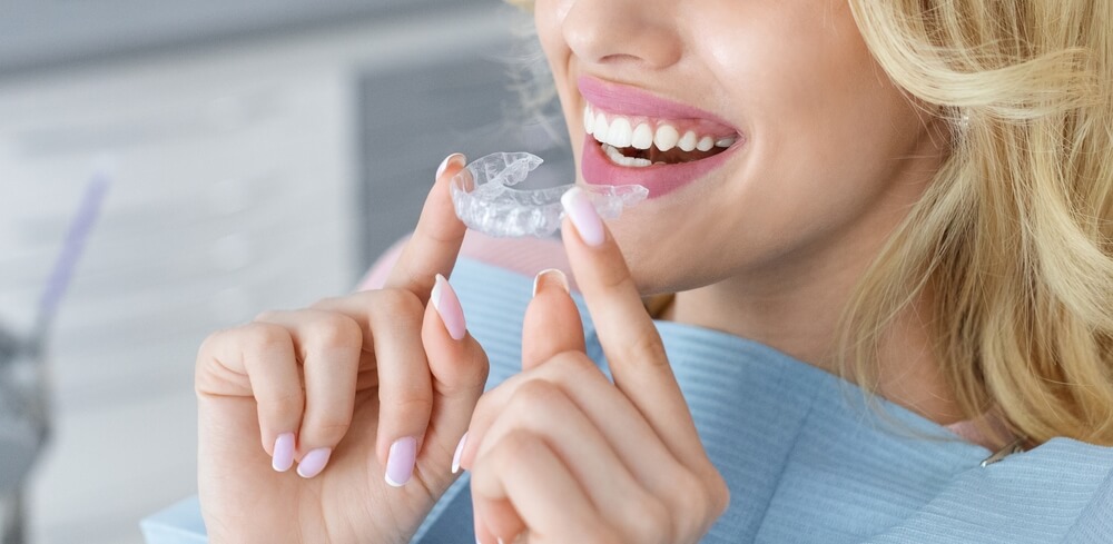 invisalign teeth attachments
