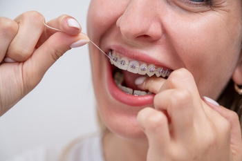 how to care for dental braces floss